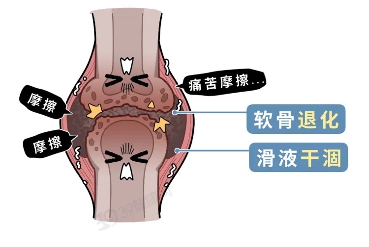 且行且珍“膝”  保护膝盖建议做好这几件事