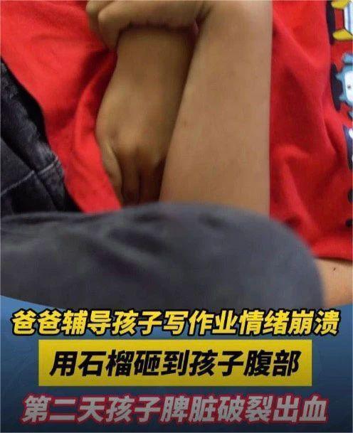 摔了一跤 男子大出血失去一器官！医生：这部位脆弱“如豆腐”