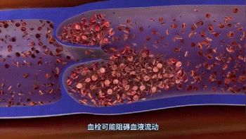 如何预防“经济舱综合征”？照这四个字做
