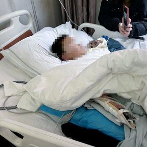 10岁男童玩未燃尽礼花右手被炸伤，医生：三个手指缺损