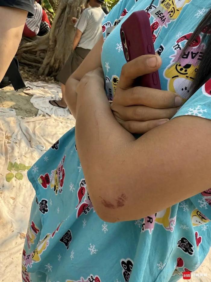 “我还活着,还喘气!” 缅甸地震幸存者讲述惊险逃生细节