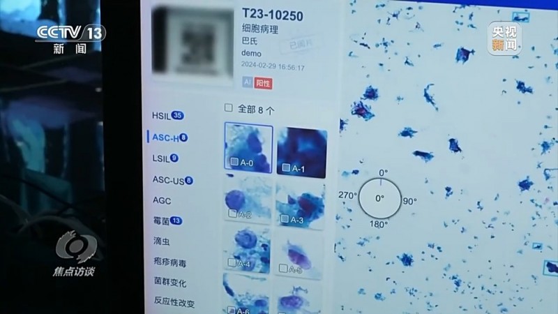 焦点访谈丨辅助诊断、AI问答、健康管理……AI正重塑医疗服务链条