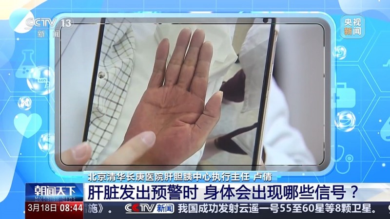 朝“问”健康丨日常生活中哪些习惯最伤肝？这些“雷”别踩