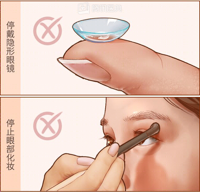 奇痒无比！一夜几百人进急诊，医生提醒：别再自行买药