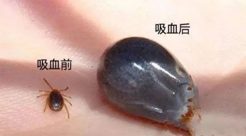 病死率高达20%！“五一”出游谨防蜱虫叮咬，预防指南来了