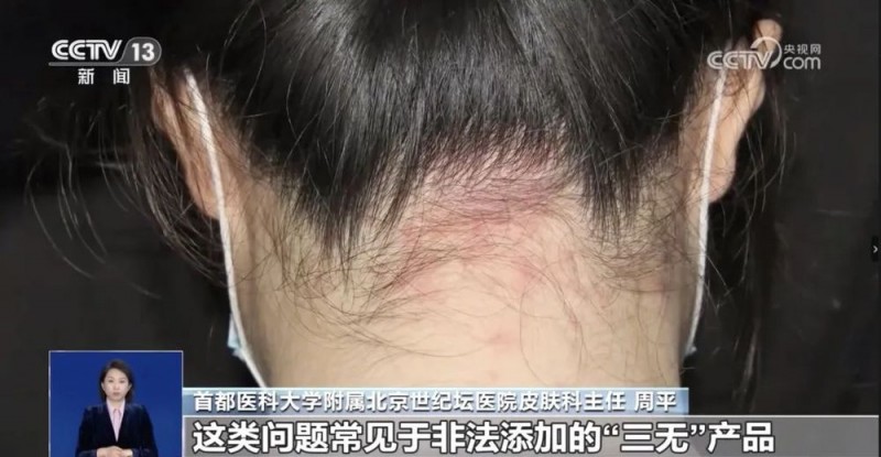 央视曝光！“爆款面膜”竟出自家庭作坊，霉菌重金属超标！