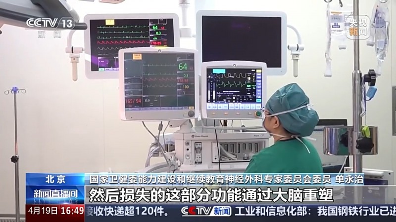 改善患者肢体运动功能 “植入式迷走神经刺激系统”临床试验启动