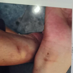 儿子在浴场宿舍突然身亡，母亲讨说法遭背铐受伤？警方否认执法有问题