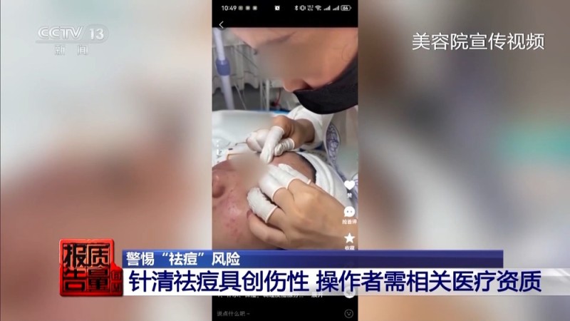每周质量报告丨“针清”后痘痘不减反增 这些祛痘法操作不当可能会“烂脸”