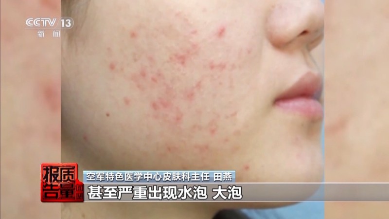 每周质量报告丨揭开防晒化妆品的“迷雾” “防护”还是“防晒”？