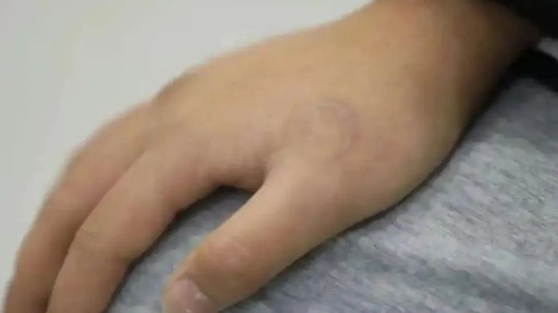 14岁少女瞒报年龄文身，近6万元清洗费谁负责？法院判了
