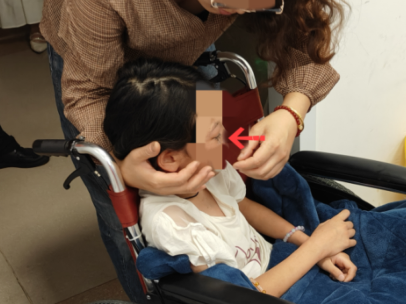 啪啪圈中的铁丝突然扎进女童右眼 家长快避雷这些玩具