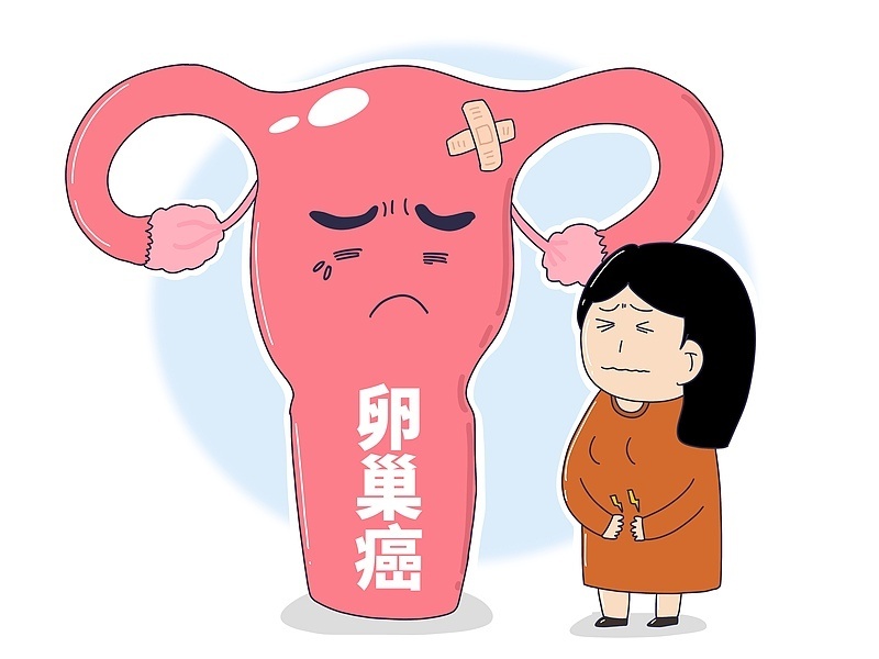女子得卵巢囊肿十几年后癌变去世 @所有女生 这些症状要警惕