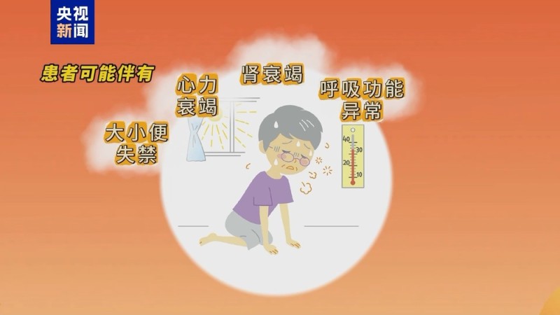 朝“问”健康丨抓住急救黄金30分钟！关于热射病 这些细节要注意