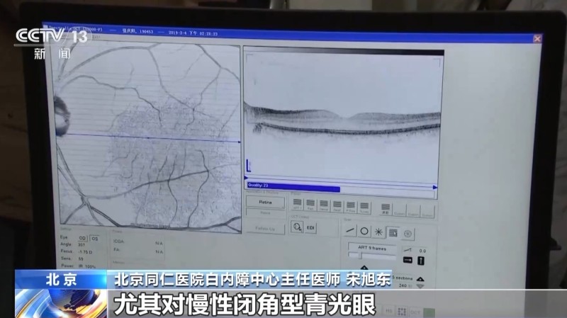 近视眼老了会老花眼吗？白内障、青光眼早期不用治疗？专家解读
