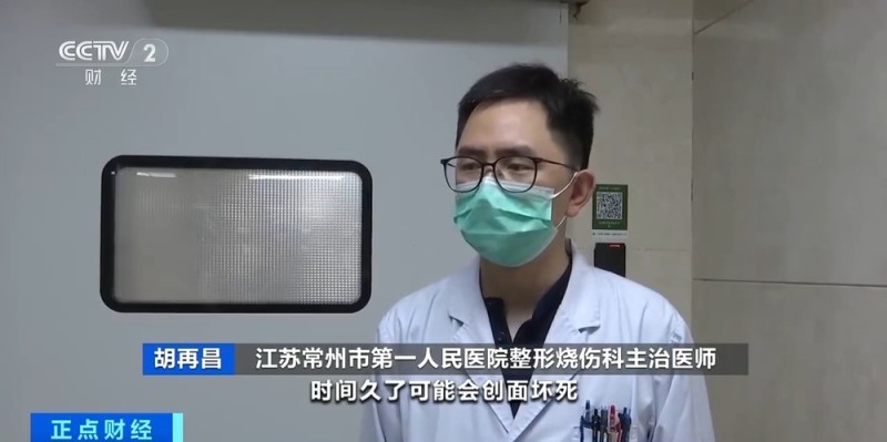 夏季高发儿童烫伤 处理不当或致严重感染