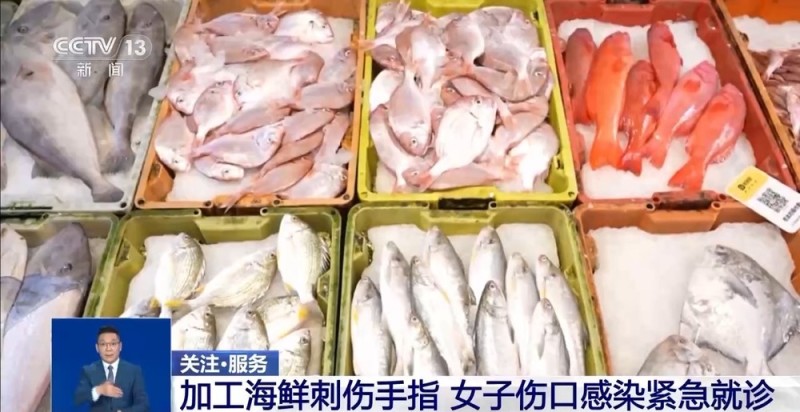 当心“海洋刺客”！男童沙滩踩到死鱼感染这种病菌险些截肢