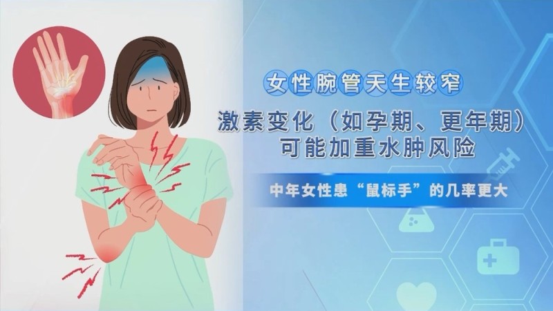 中年女性患“鼠标手”的概率更大 “鼠标手”是怎么发生的？