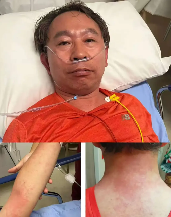 协和医生自述头孢过敏惊险经历 紧急提醒：吃药要注意这些事