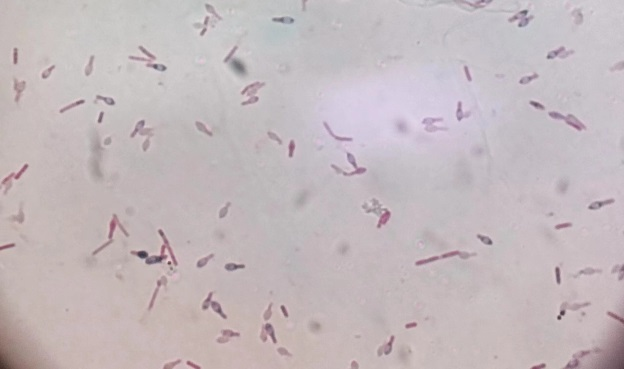 真空包装不是“安全袋”!看完赶紧查冰箱