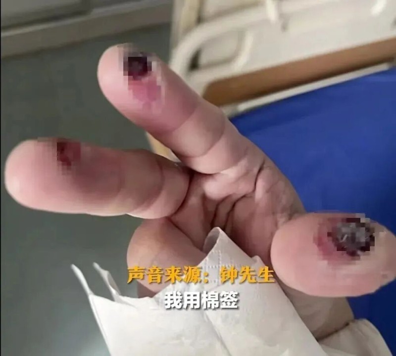 警惕清洁剂中隐藏的“化骨水”！你家可能也有→