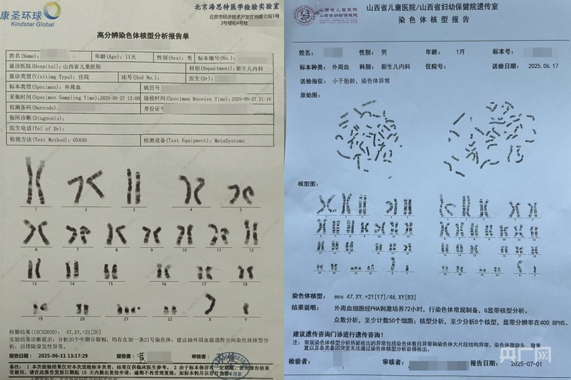 啄木鸟消费投诉|孕检投保遇理赔坎:唐氏儿分型不同,保险公司拒赔付