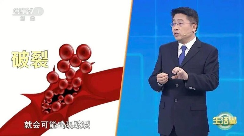 秋冬季高发 “脑中风”危害比你想象中还大