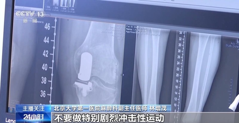 老年人遇到这些身体疼痛勿硬扛 或是健康重要预警信号