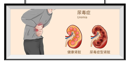 原来血液透析是这么回事！4个关键问题，帮你读懂生命守护技术 | 科普时间