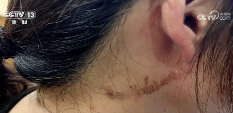 近期“飞行的硫酸”活跃，遇到千万别拍！