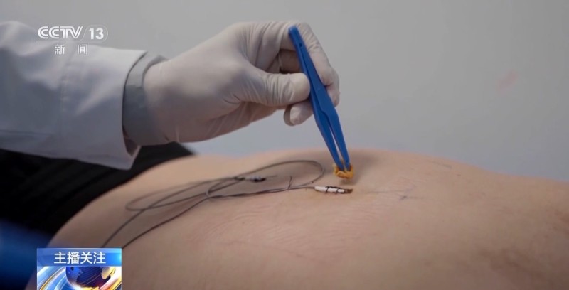 老年人遇到这些身体疼痛勿硬扛 或是健康重要预警信号