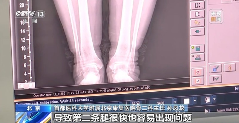 降温了,你的骨关节还好吗?这份防护指南请收好