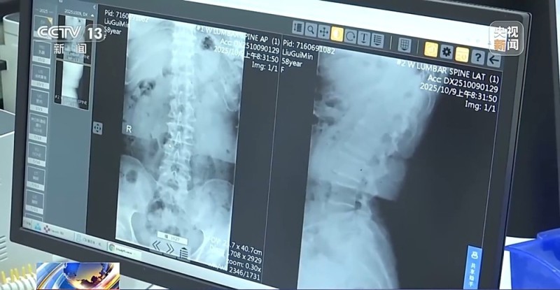 降温了,你的骨关节还好吗?这份防护指南请收好