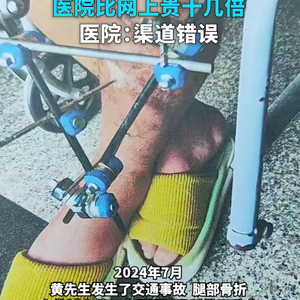 患者术后自查耗材价格,医院比网上贵十几倍,医院:购买方式不对导致