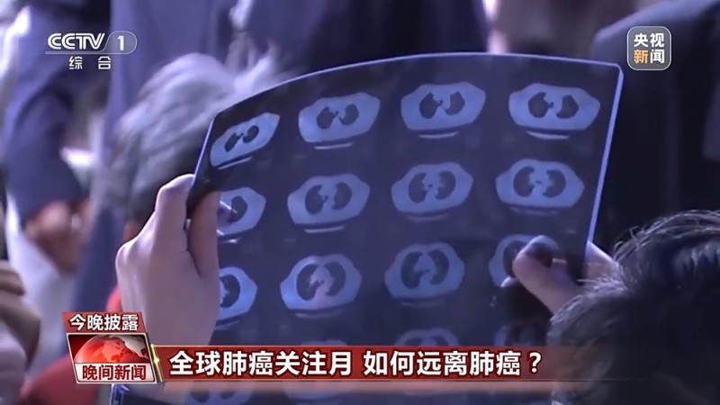 肺结节≠肺癌 专家建议这些人群应做胸部CT