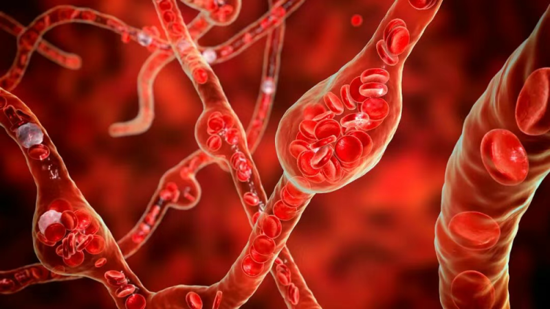 锻炼不当反伤血管!这几种运动不适合老年人→